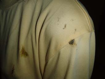 �����ԃR�E�����̕��𗎂Ƃ��ꂽ